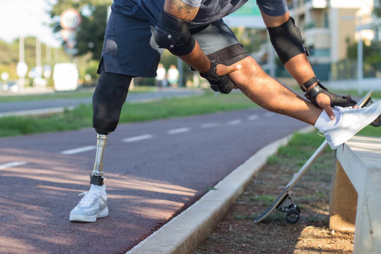 Artificial Limb Fabrication & Distribution